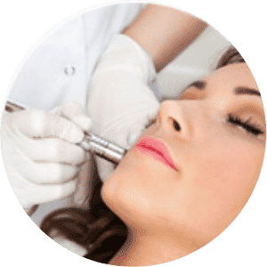Laser Treatment For Pimples And Acne