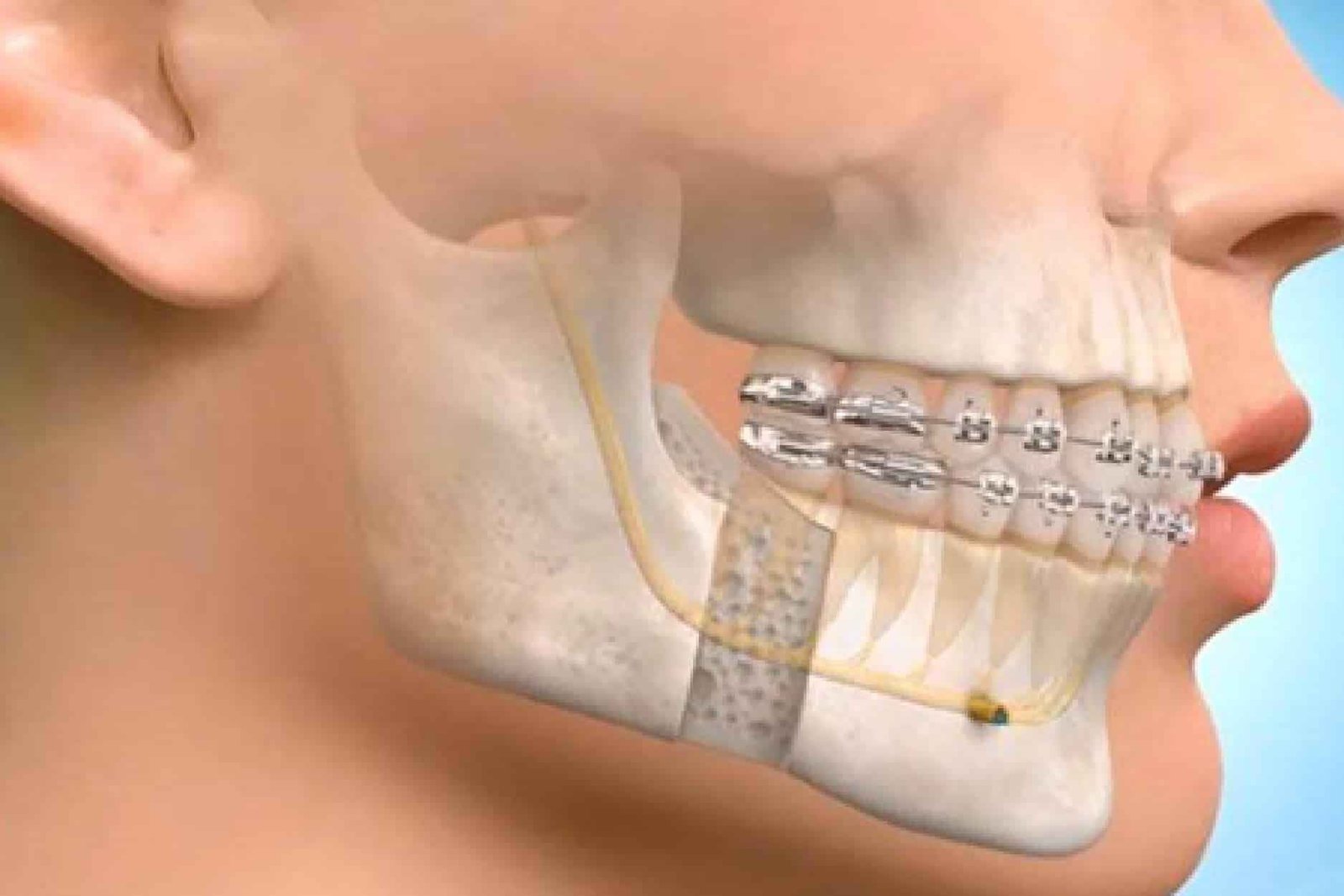 Maxillofacial Surgery in Bangalore