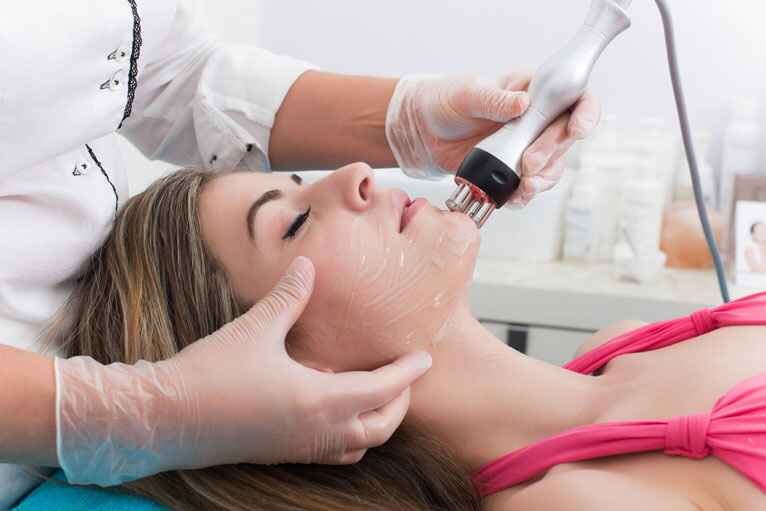 Best Acne laser Treatment in Bangalore